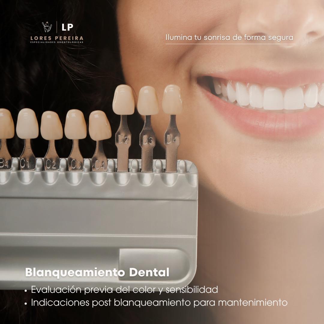Aclaramiento Dental en Consultorio en Lores Pereira - Especialidades Odontológicas