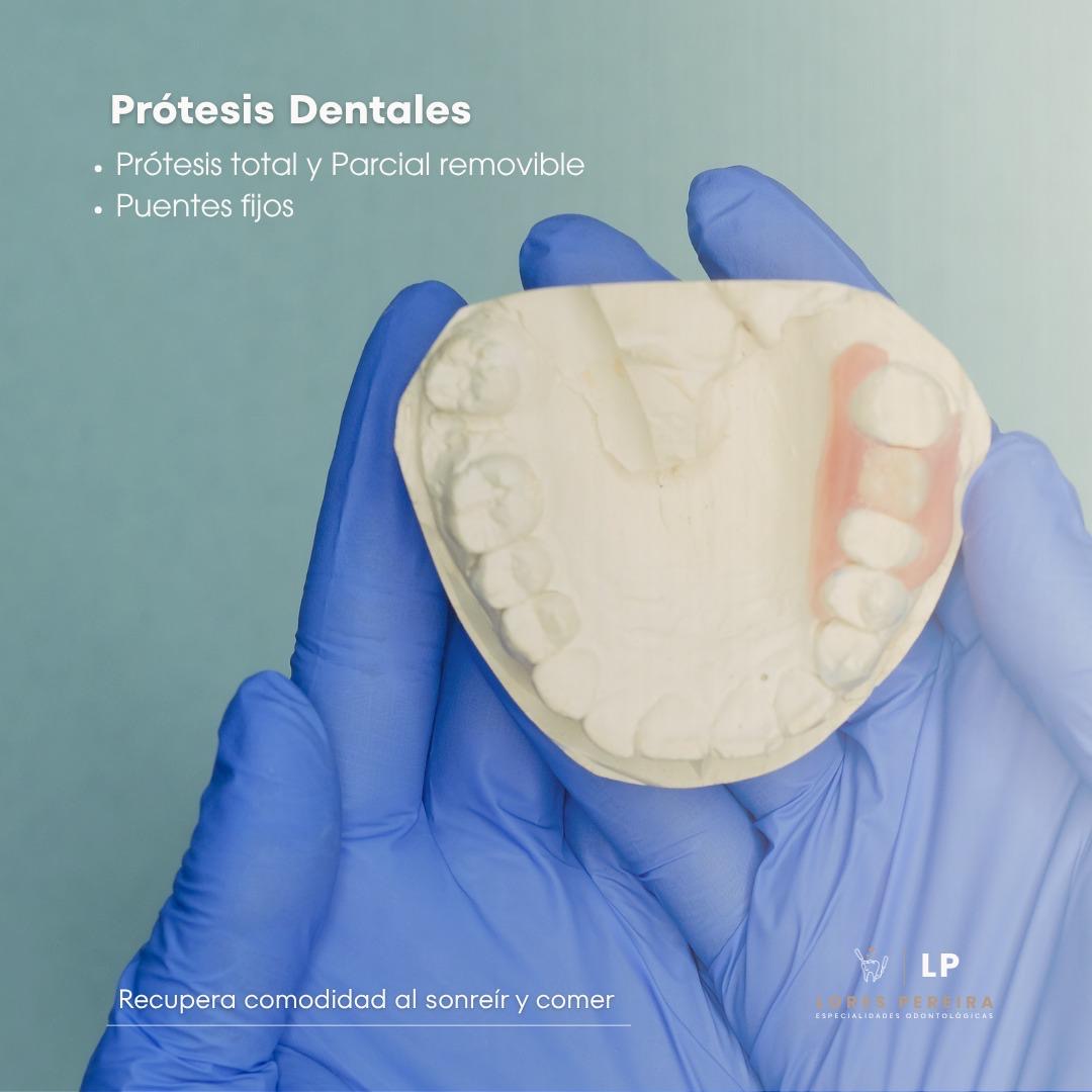 Rehabilitación Oral en Lores Pereira - Especialidades Odontológicas
